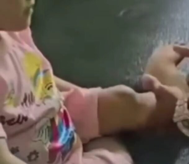 Bocah di Nias alami cacat permanen, setelah diduga mendapatkan perlakukan kekerasan Secara Fisik. Foto: Dok. Istimewa.