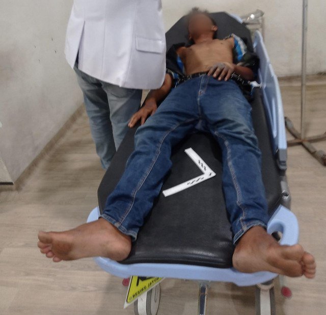 Pria di Deli Serdang diduga dibakar oleh ASN lantaran mencuri ubi. Foto: Dok. Istimewa