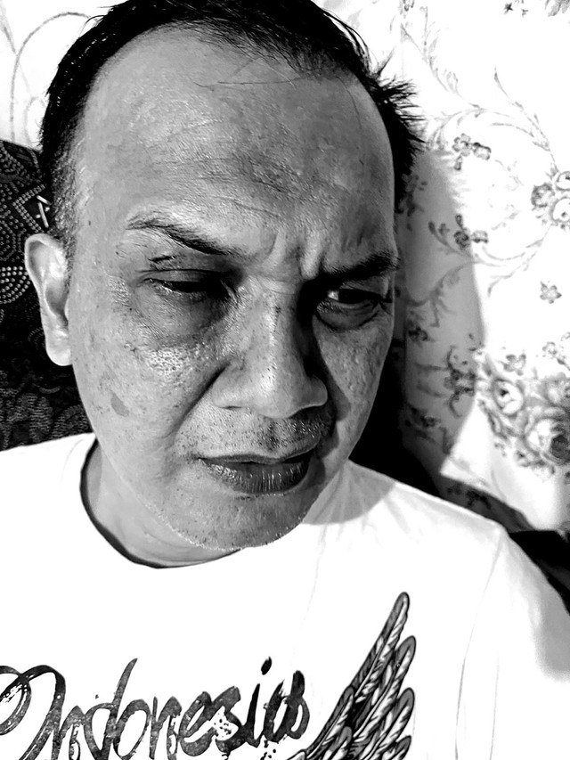 Kondisi Lurah Manggarai Selatan Muhamad Sidik babak belur usai diamuk massa demo. Foto: Dok. Istimewa