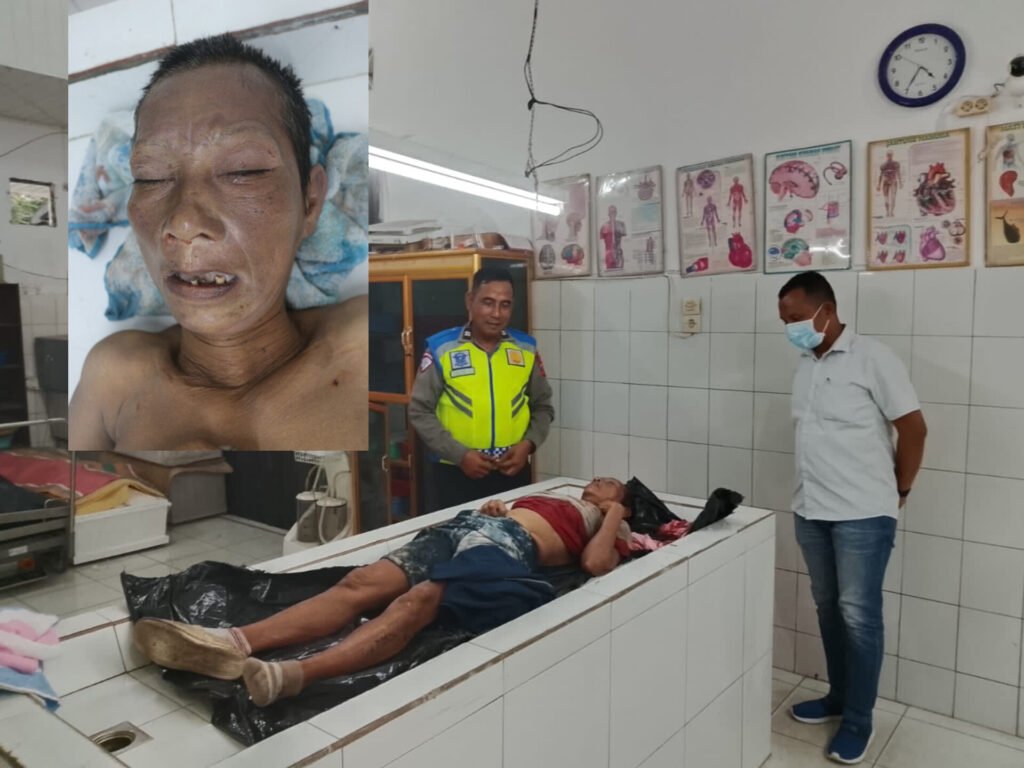 Foto korban tabrak lari tanpa identitas alias Mr X. Foto: Dok. Humas Polres Simalungun.